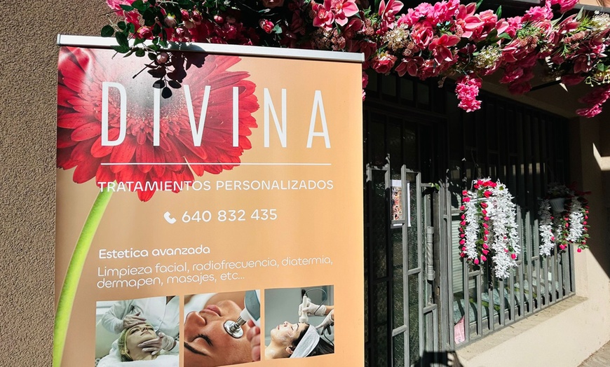 Image 5: Limpieza facial con microdermoabrasión y opción a tratamientos extra