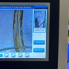 Image 2: Scalp Analysis and Hair Restoration Consultations
