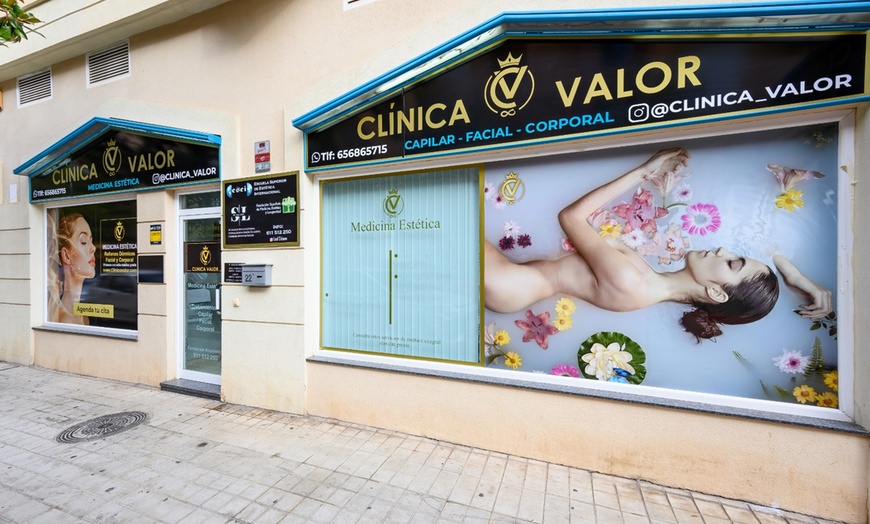 Image 15: ¡Hilos tensores monofilamento con opción a mesoterapia!