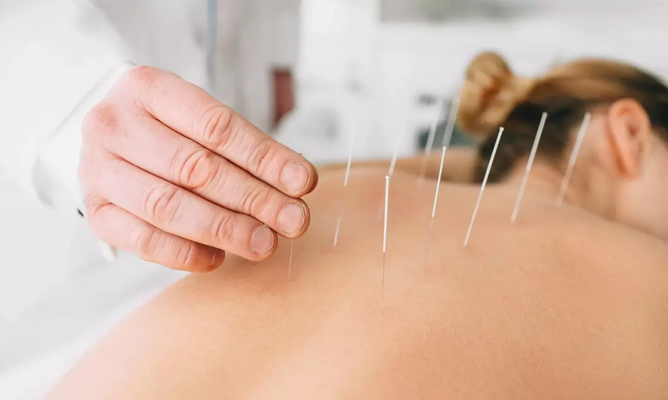 Experience One Dry Needling Session with Electrical Stimulation and Infrared Light Therapy ( Up to 50% Off ) - Primary Image