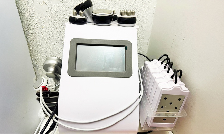 Image 8: Tratamiento facial con dermapen y opción a extras para 1 persona