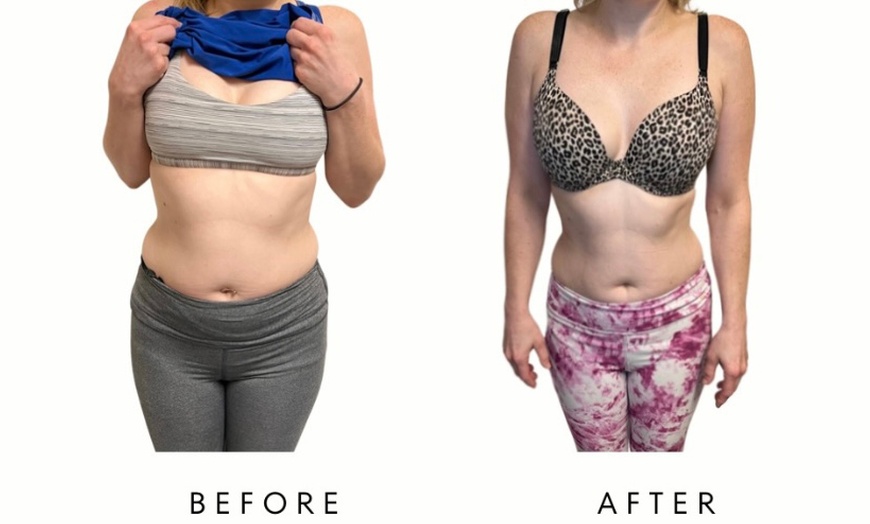 Image 2: PRECISION SLIM - Body Fat Loss & Skin Tightening at Your Sculpt Studio