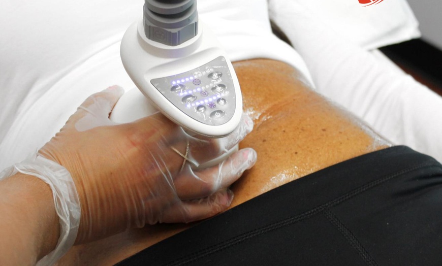 Image 7: One or Three Venus Legacy RF Skin Tightening Treatments