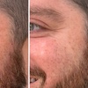 Image 3: Revitalize with 30 or 60 Units of Dysport at Youthful Glow