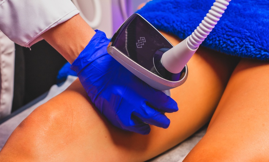 Image 3: Radio Frequency Skin Tightening Session w/ Ultrasound / Microneedling
