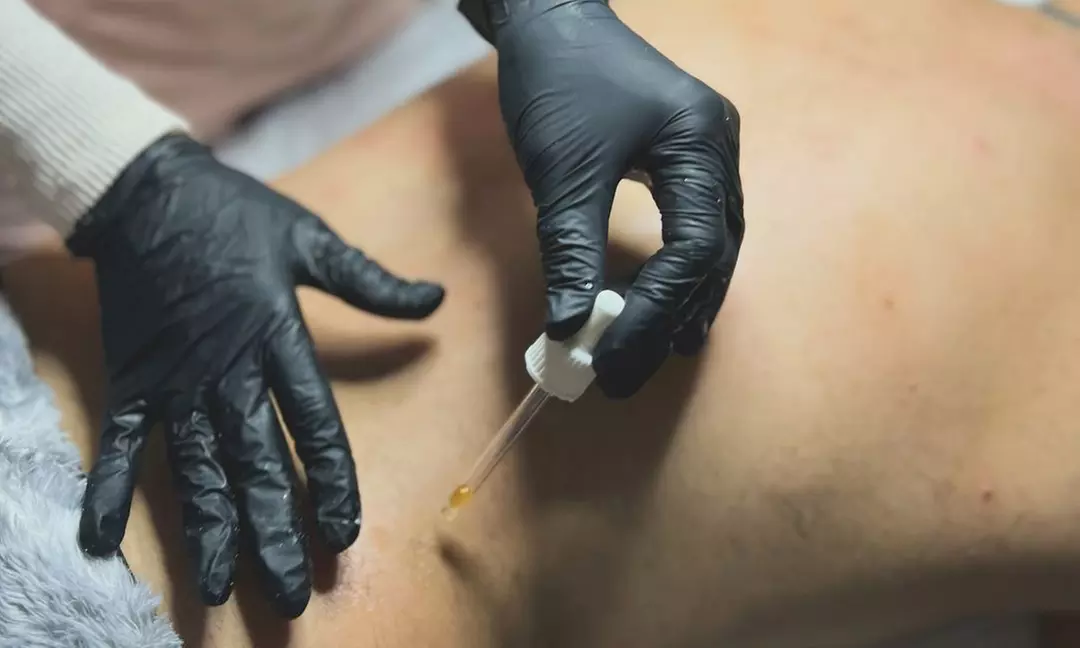 One or Three PRP Nano Facial Treatment with Microneedling