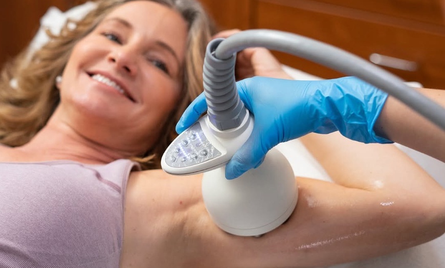 Image 3: One or Three Venus Legacy RF Skin Tightening Treatments