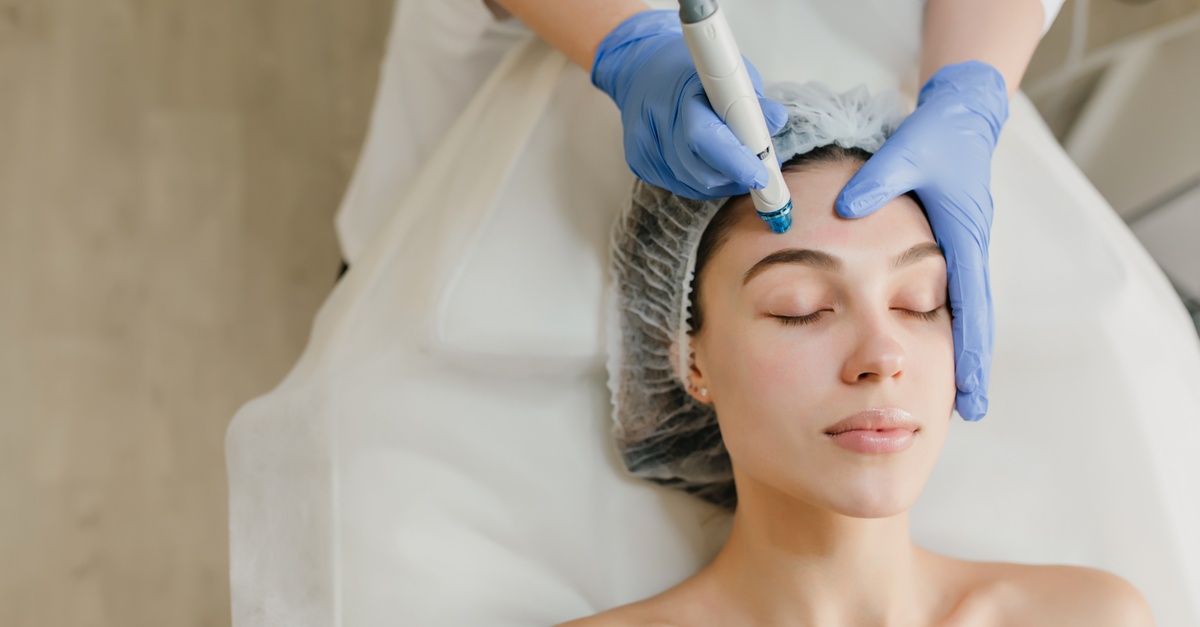 Tratamiento facial Dermapen en Córdoba