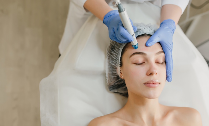 Image 1: Tratamiento facial Dermapen con cóctel rejuvenecedor y extras 
