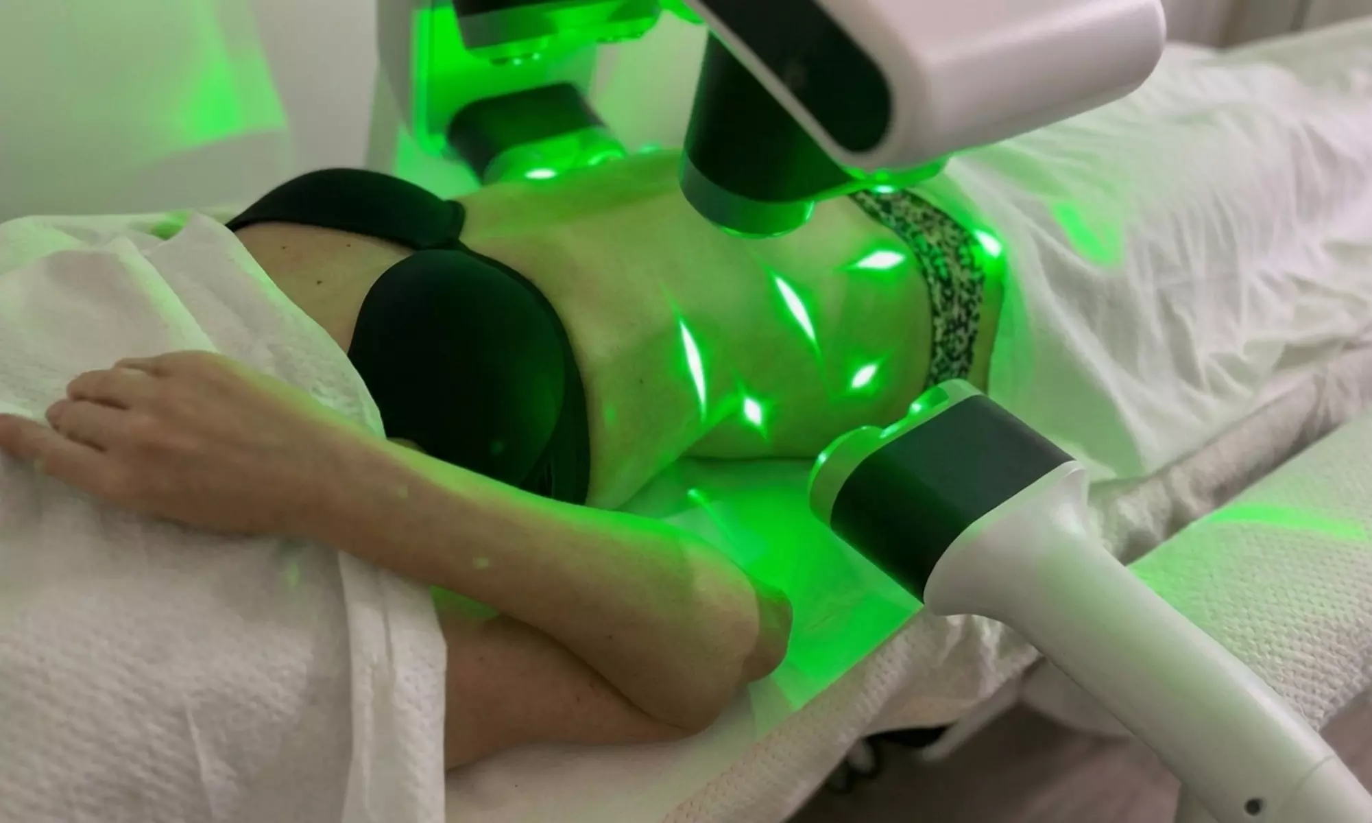 2, 4 o 6 sesiones liposucción sin cirugía con Emerald Láser