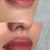 Image 4: Get Flawless Lips with One Lip Blush Session with Optional Touch-Up