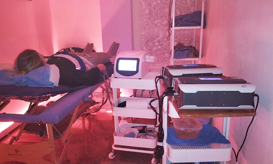 Image 19: 1 sesión de exososomas con Dermapen y opción a tratamiento adicional