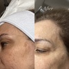 Image 2: Diamond Peeling Facial for Radiant Skin