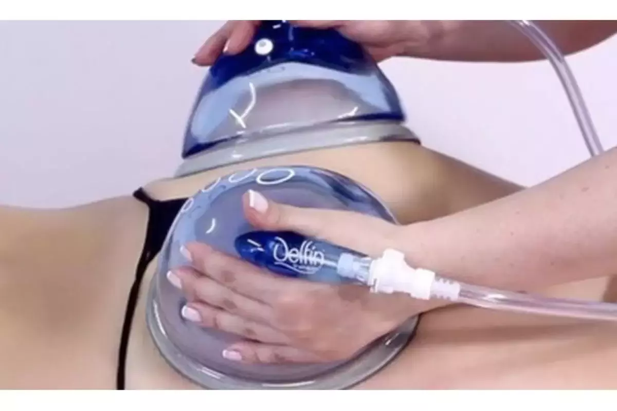 Achieve Enhanced Results of Aviani Beauty's Butt Cupping Vacuum Butt Lift with (Up to 76% Off) - Primary Image