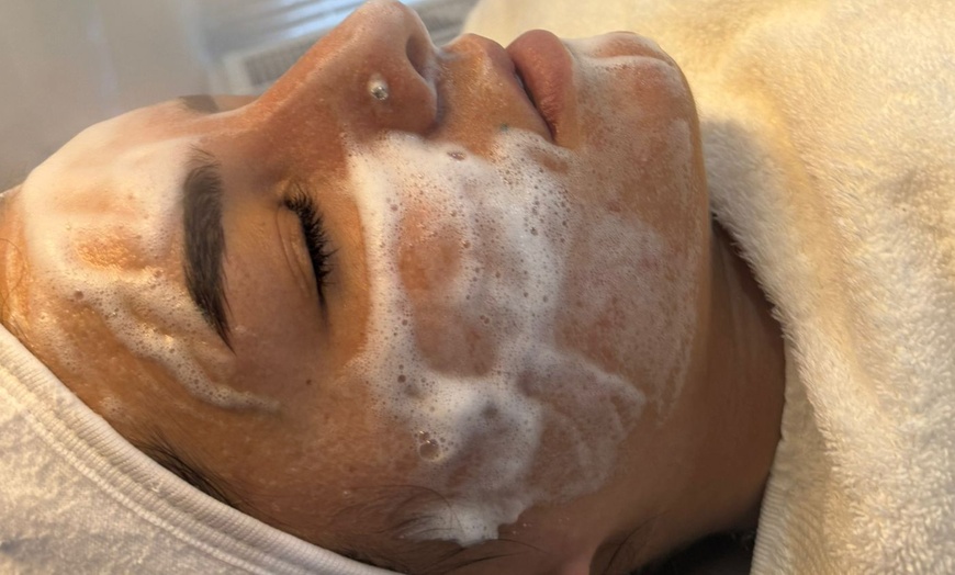 Image 2: 45 Min. Mikrodermabrasion / 60 Min. Mikrodermabrasion & Microneedling