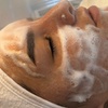 Image 2: 45 Min. Mikrodermabrasion / 60 Min. Mikrodermabrasion & Microneedling