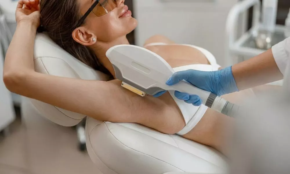 IPL Hair Reduction Consultation, Treatment, and Personalized Plan