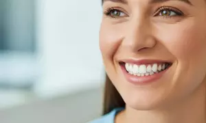 Blanchiment dentaire Ulta-White, une ou deux séances de 60 minutes au Cabinet de Beauté (jusqu'à 48% de remise)