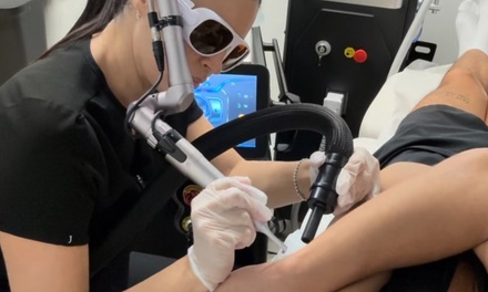 Three Laser Tattoo Removal Sessions on one Area (1x1 inch or less) - South Florida Laser Studio