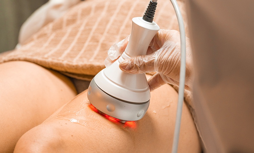 Image 3: 5 séances d'épilation laser sur une petite, moyenne ou grande zone 