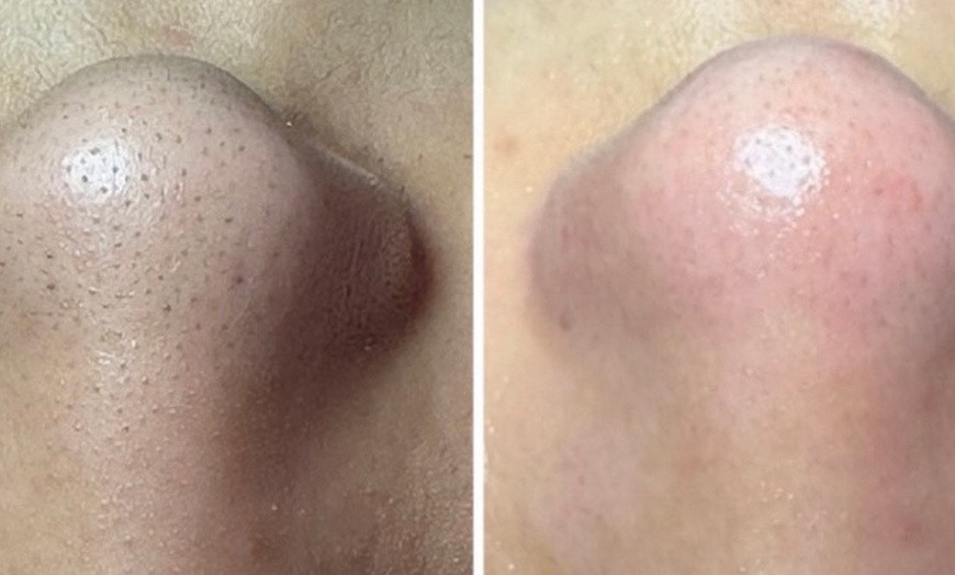 Image 5: Soin du visage hydratant, anti-âge ou coup d'éclat chez Mybodyfull
