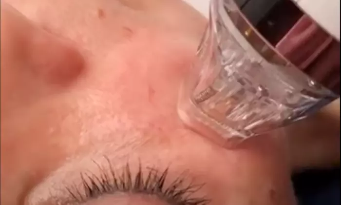 Revitalize your skin: 1x, 3x, or 5x RF Micro-Needling Facial (60-Min)