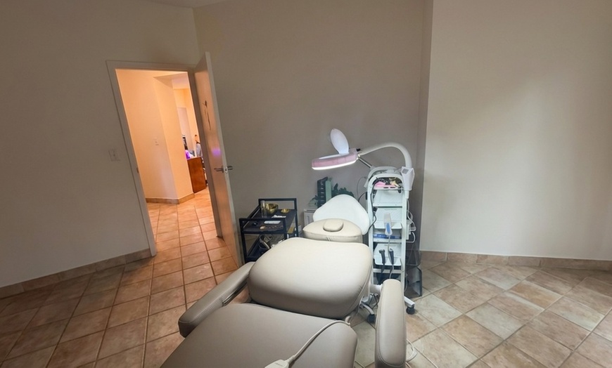Image 4: One, Three or Five Microdermabrasion Facial Sessions for Smoother Skin