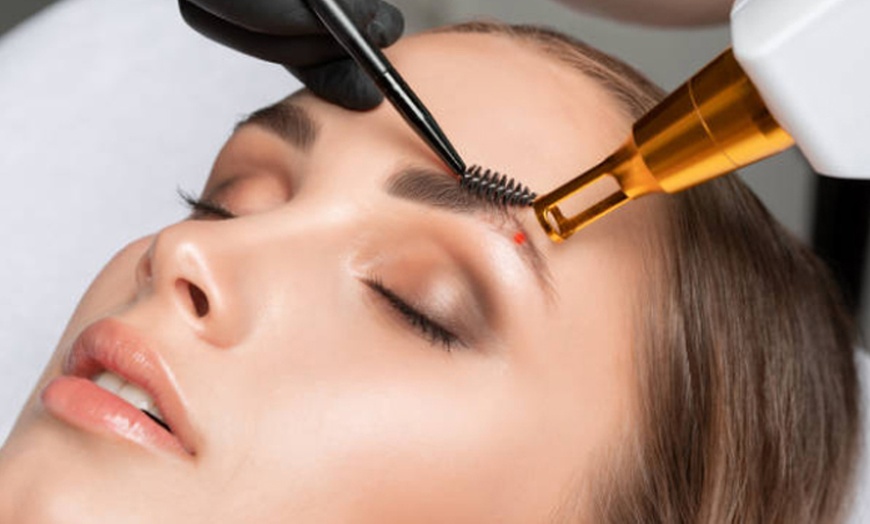 Image 1: Tattoo Removal - Any Area, Skin Camouflage, or Eyebrow Tattoo Removal