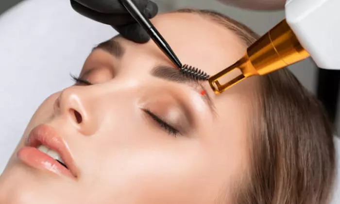 Tattoo Removal-Any Area, Skin Camouflage, or Eyebrow Tattoo Removal at Flashback Skin Camouflage (Up to 49% Off) - Primary Image