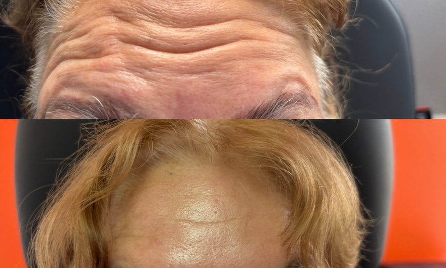 Image 7: Revitalize with 20, 40, or 60 units Units of Jeuveau