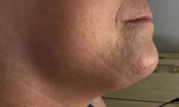 Relax with Cryo & Thermal Body sculpting (2 or 3 sessions)