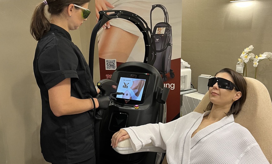 Image 3: 3 / 5 Sitzungen: Diodenlaser-Haarentfernung an 1 kleinen / großen Zone