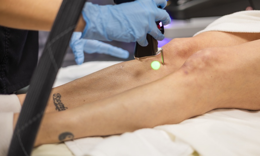 Image 6: Say Goodbye to Unwanted Hair with Six Laser Hair-Removal Sessions