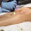 Image 6: Say Goodbye to Unwanted Hair with Six Laser Hair-Removal Sessions