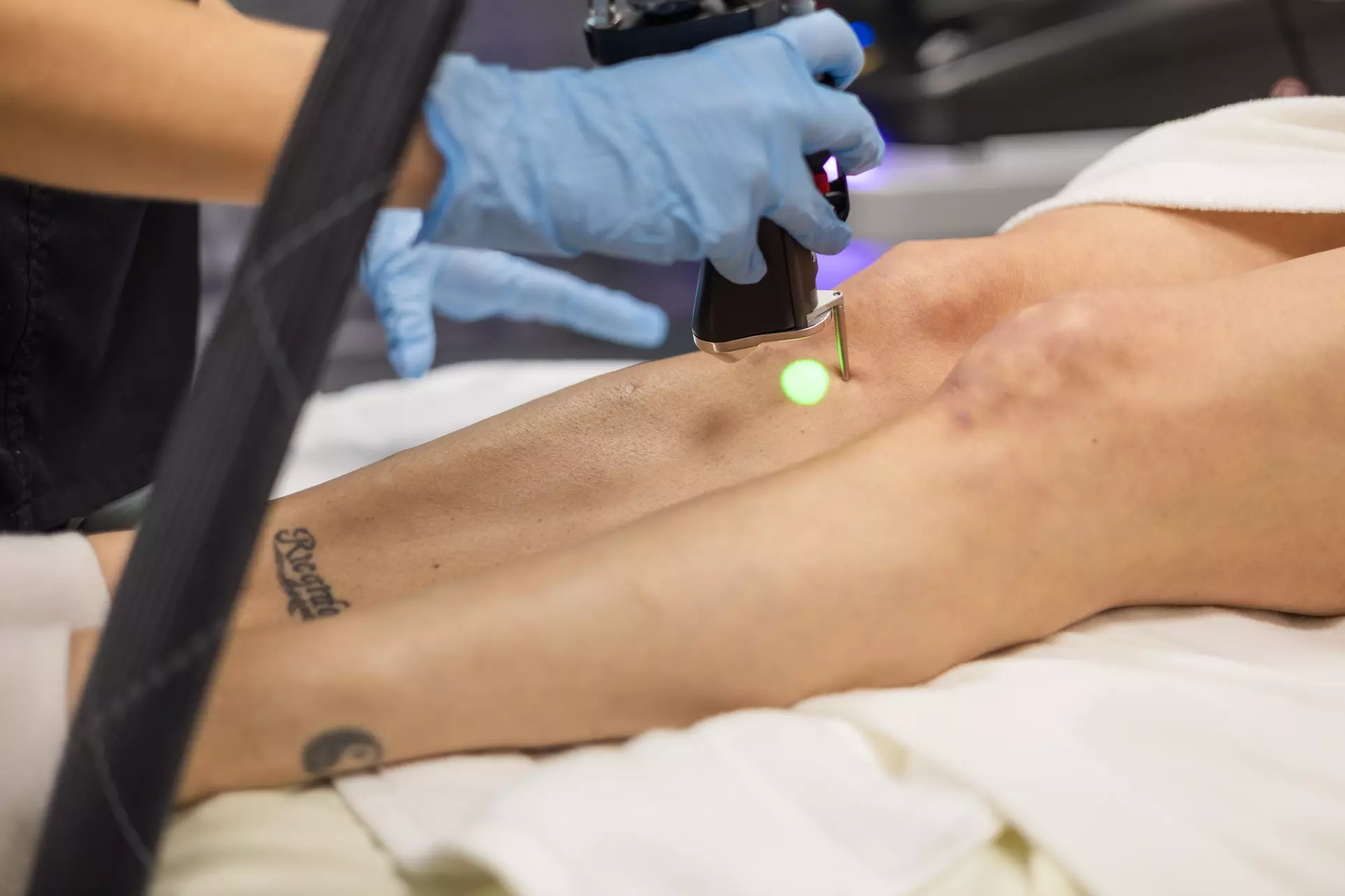 Say Goodbye to Unwanted Hair with Six Laser Hair-Removal Sessions