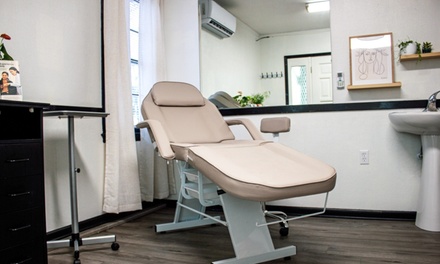 One Micro-Needling Treatment with PRP - BioSync Wellness KC