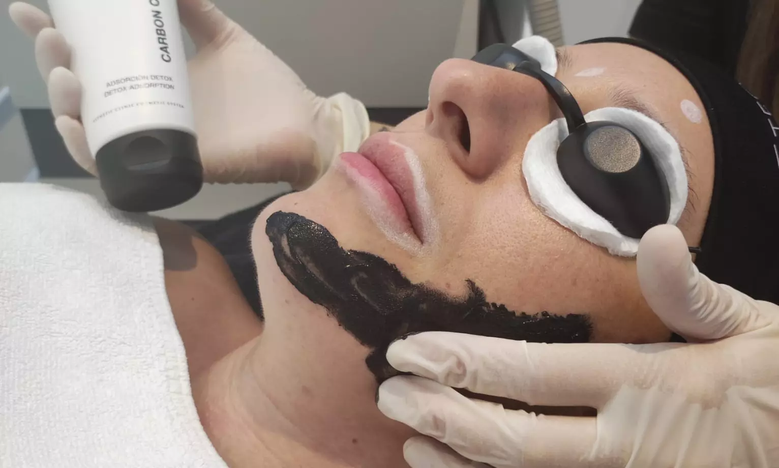Tratamiento facial con láser en Sapphira Prive Madrid centro