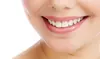 Smile Makeover: Exam, X-Rays, Cleaning & Veneers Credit at Harwood Dental (Up to 77% Off)