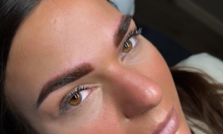 Image 6: Permanent mooie oogopslag: PMU behandeling naar keuze