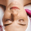 Image 1: Transform Your Skin with One 45-Minute Microneedling Session