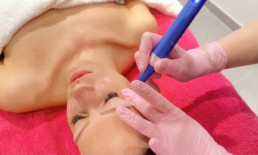 Image 4: Gezichtsbehandeling of huidverbetering naar keuze