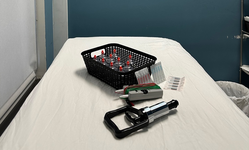 Image 3: Boost Wellness with One, Two, or Three Acupuncture Sessions