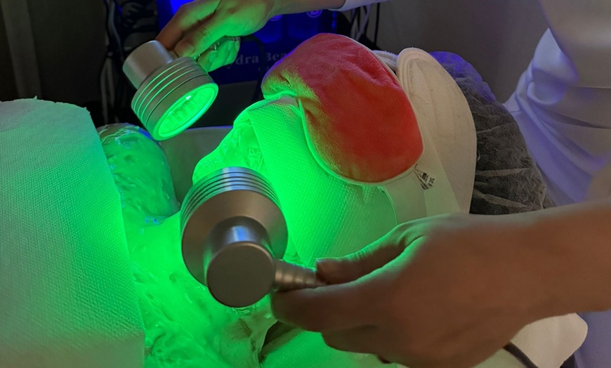 Image 3: 1 oder 2x Microneedling-Gesichtsbehandlung (45-60 Min.) für 1 Person