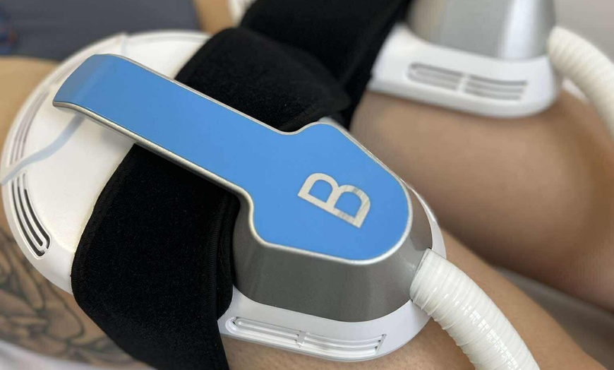 Image 3: Odkryj moc EMS Sculpt – 1, 3 lub 6 zabiegów dla wymarzonej sylwetki