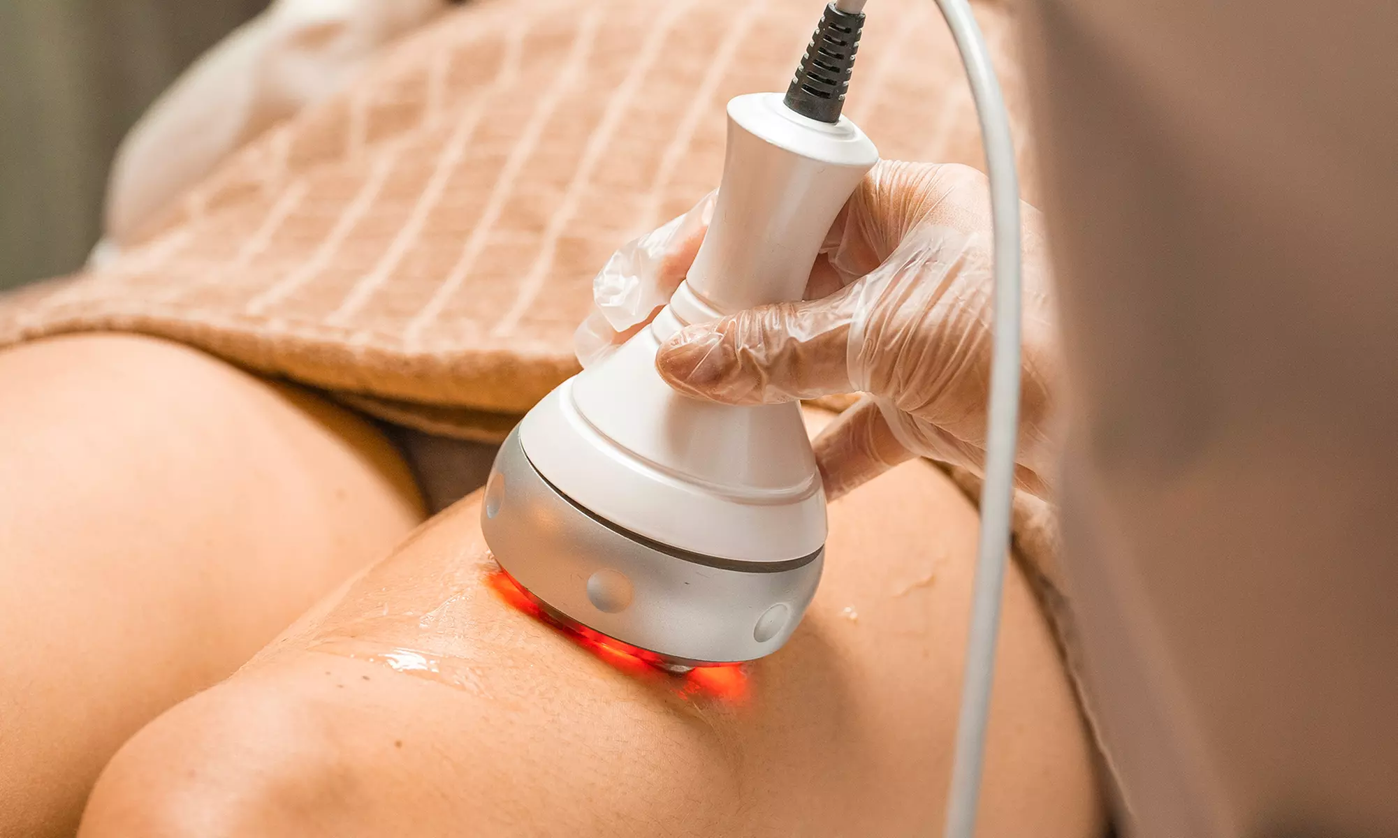 1 ou 2 séances de cryolipolyse de 45 à 60 min sur 1 ou 2 zones