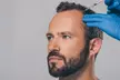 Enhance Your Hair Volume with One, Two, or Three PRP Hair-Restoration Treatment @Shah Wellness (Up to 53%Off) - Second Medium