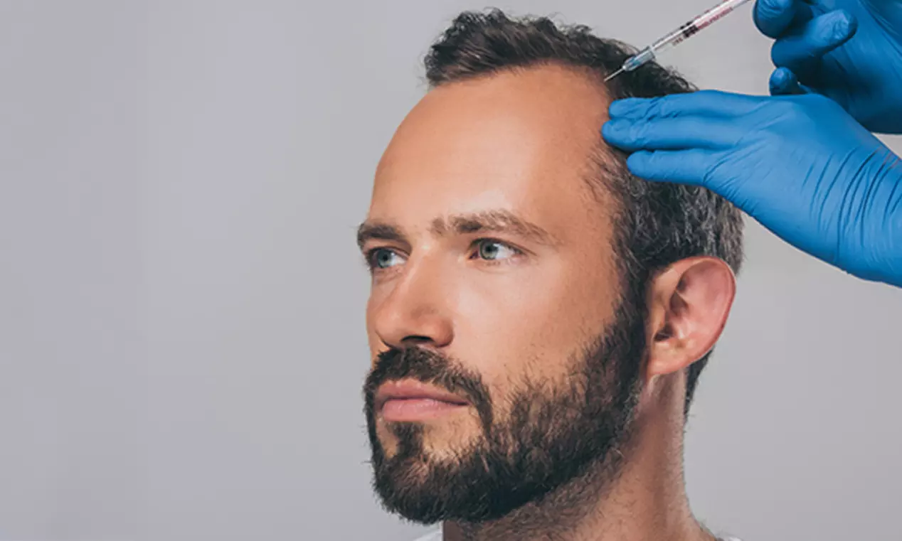 Enhance Your Hair Volume with One, Two, or Three PRP Hair-Restoration Treatment @Shah Wellness (Up to 53%Off) - Primary Image