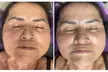 BK Eyebrow Threading & Henna Tattoo: Customized 60-Minute Advanced Facial of Choice One or Two (Upto 74% OfF) - Second Medium