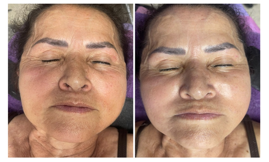 Image 7: Relax with Customized 60-Minute Advanced Facial of Choice One or Two!