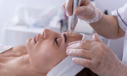One Microneedling Treatment for Full Face with HA - Revitamaxx